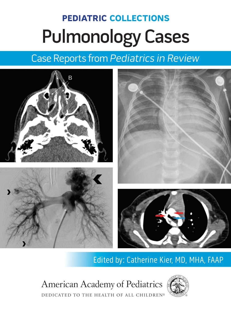 Cover of Pulmonology Cases