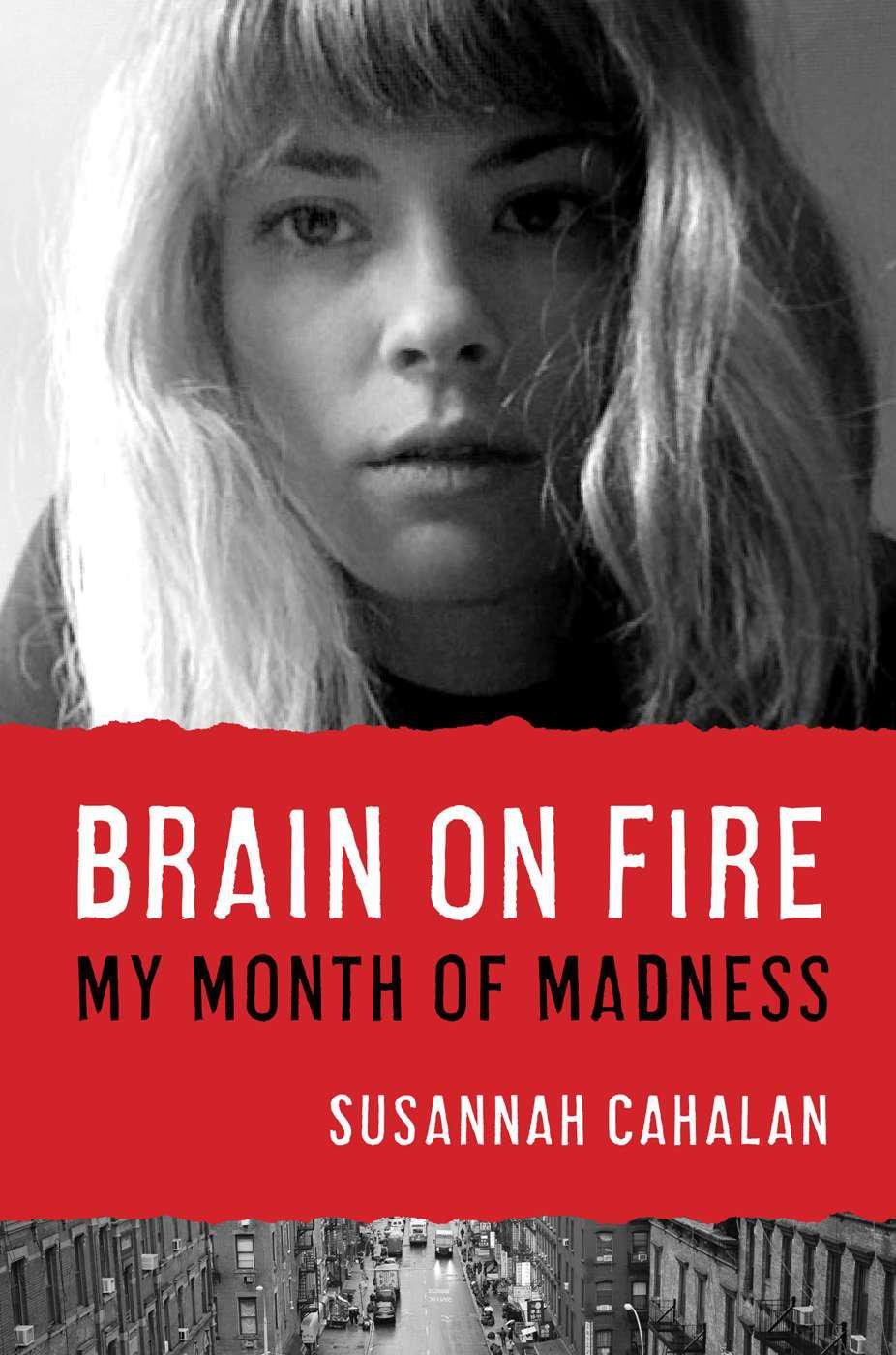 Cover of Brain on Fire